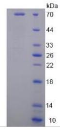 SDS-PAGE (LGALS9-432H).jpg